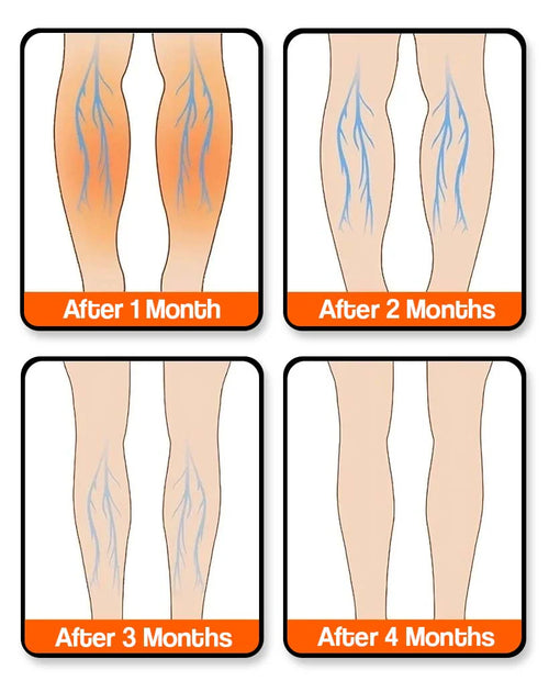 Full Leg Compression Massager